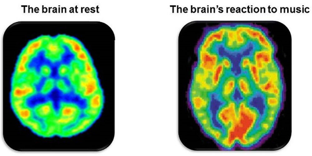 Musikk er mosjon for hele hjernen