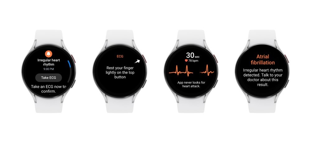 Galaxy Watch vil kunne varsle deg om hjerteproblemer