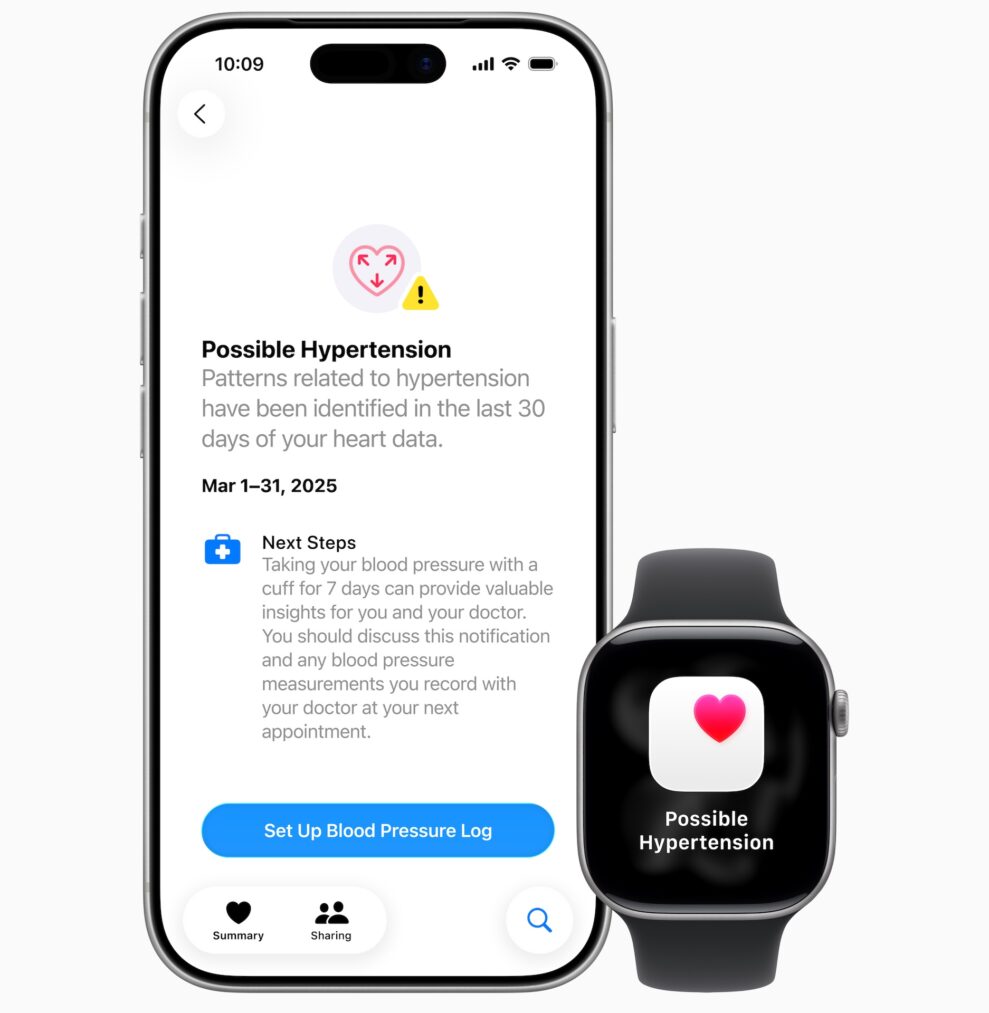 Apple Watch Series 11 4 Apple Watch Series 11 4