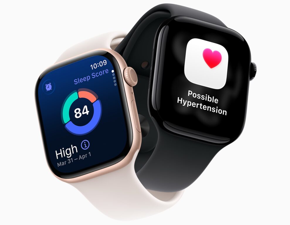 Apple Watch Series 11 3 Apple Watch Series 11 3