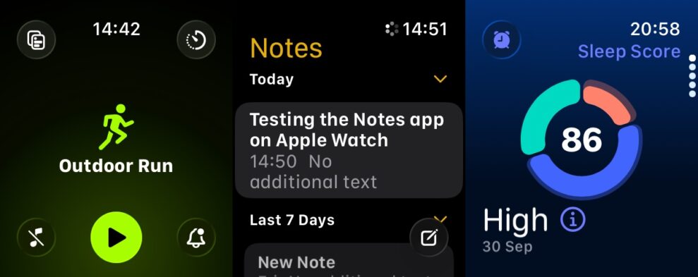 Apple Watch Series 11 2 Apple Watch Series 11 2